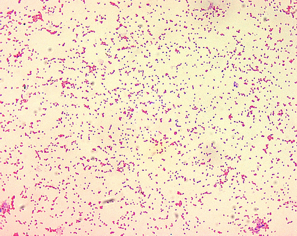 Coloration gram morphology