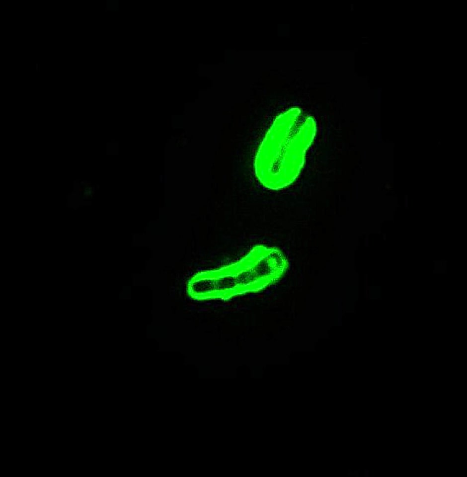 Antibody capsule magnification
