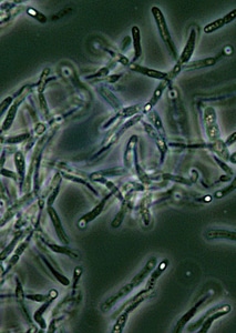 Bacillus contrast microscopy photo