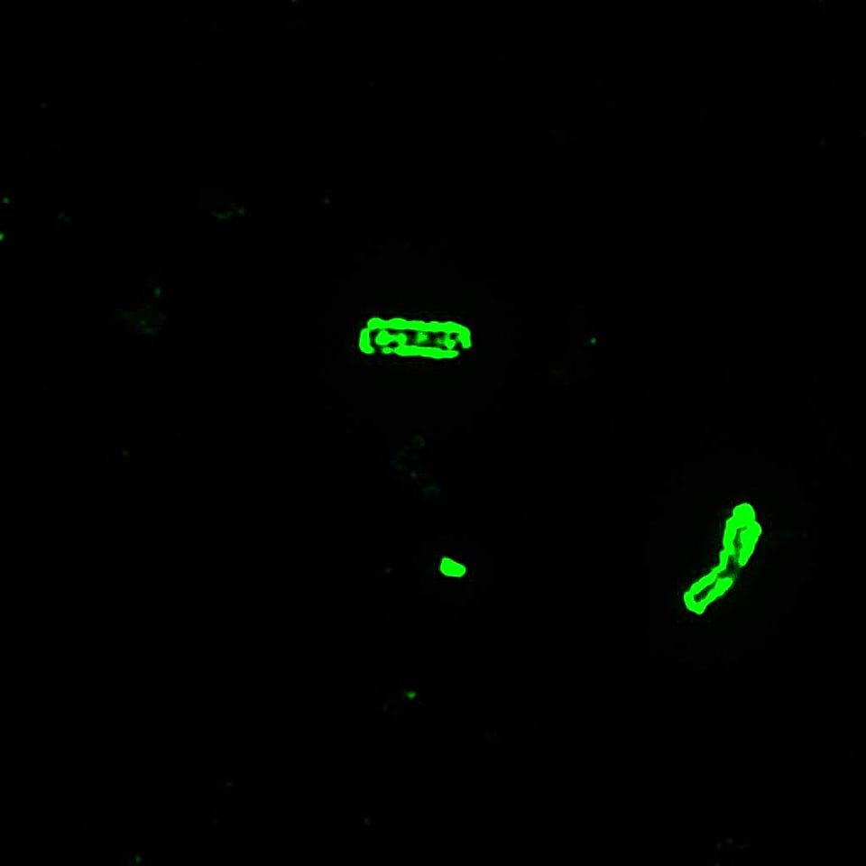 Antibody bacillus microscopy
