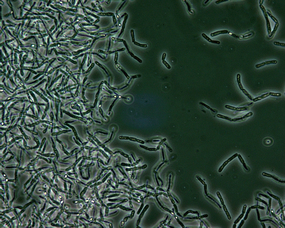 Bacillus contrast lighter