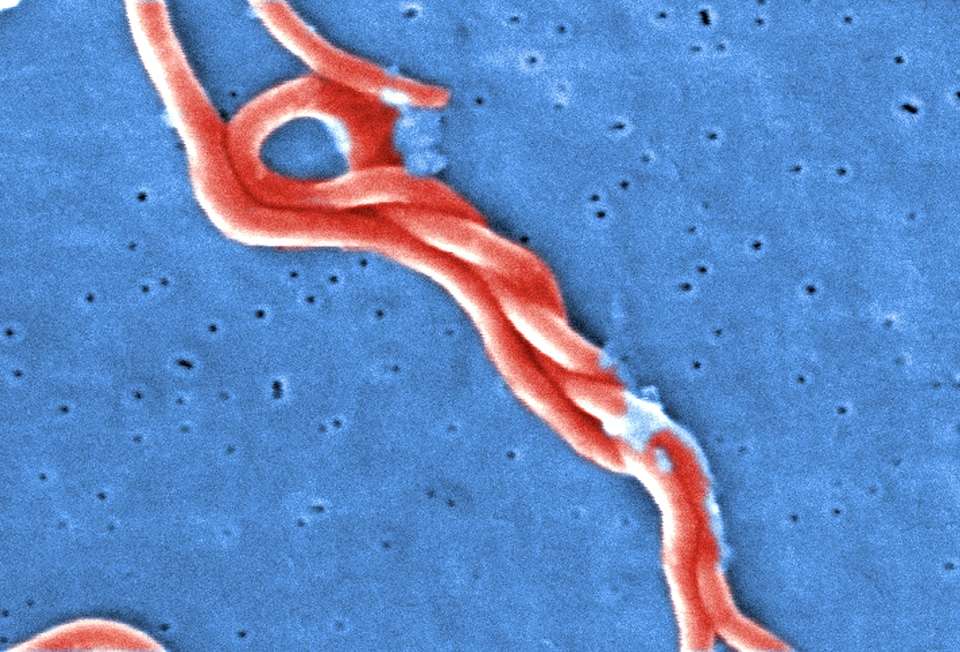Bacteria Borrelia spirochaetaceae gram