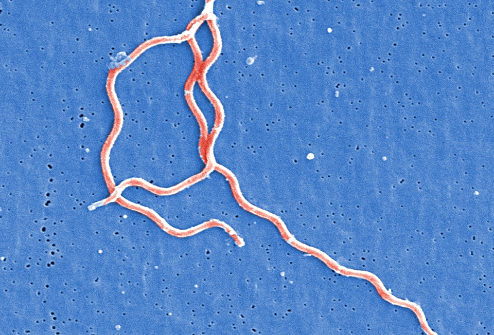 Bacteria Borrelia spirochaetaceae gram
