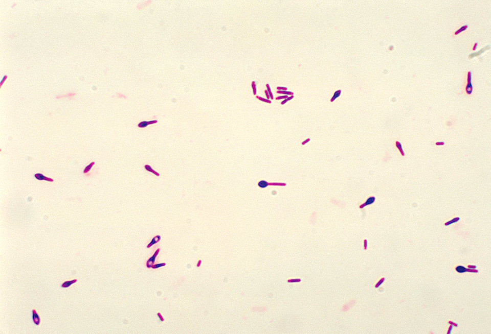 Art clostridium gram