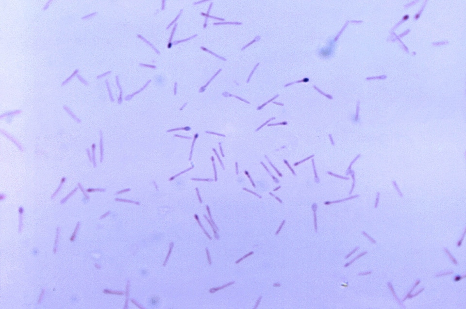 Bacteria cell clostridium