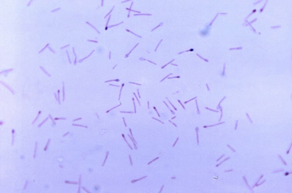 Bacteria cell clostridium photo