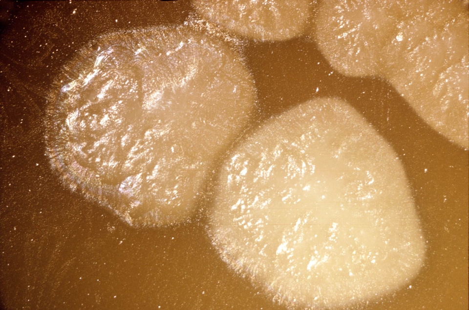Area art clostridium