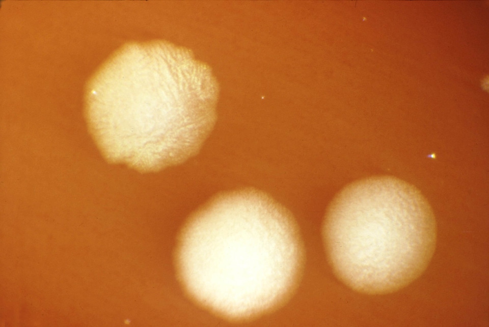 Bacteria clostridium family