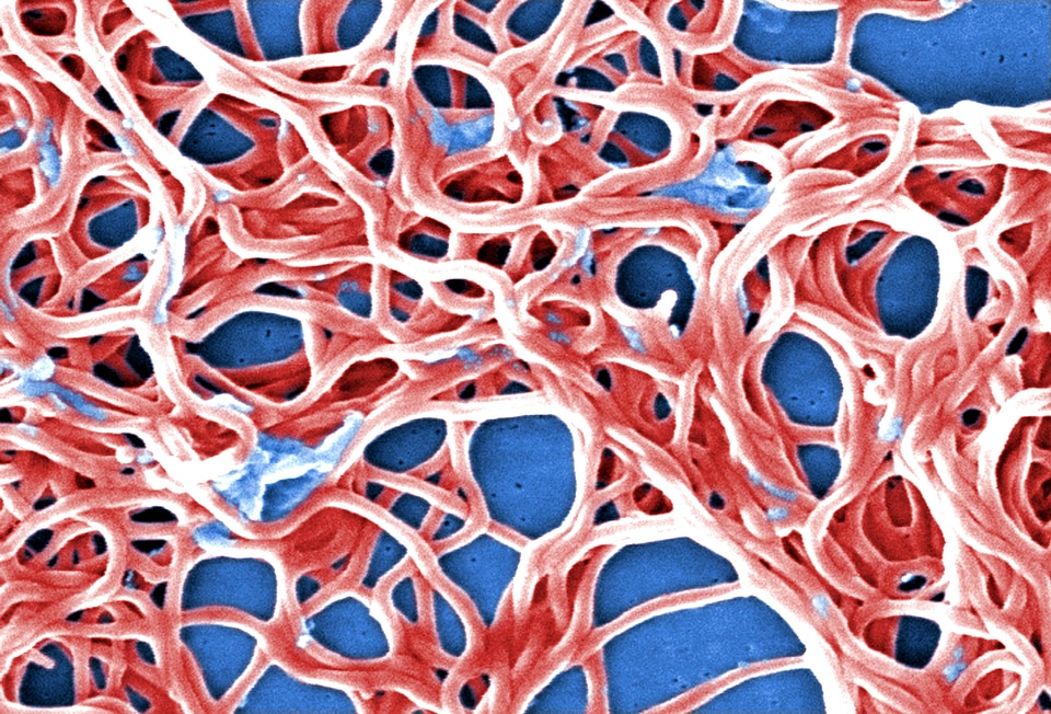 Bacteria Borrelia spirochaetaceae electron