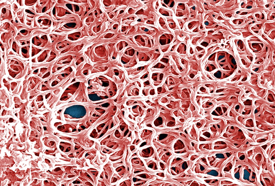 Appearance bacteria feather