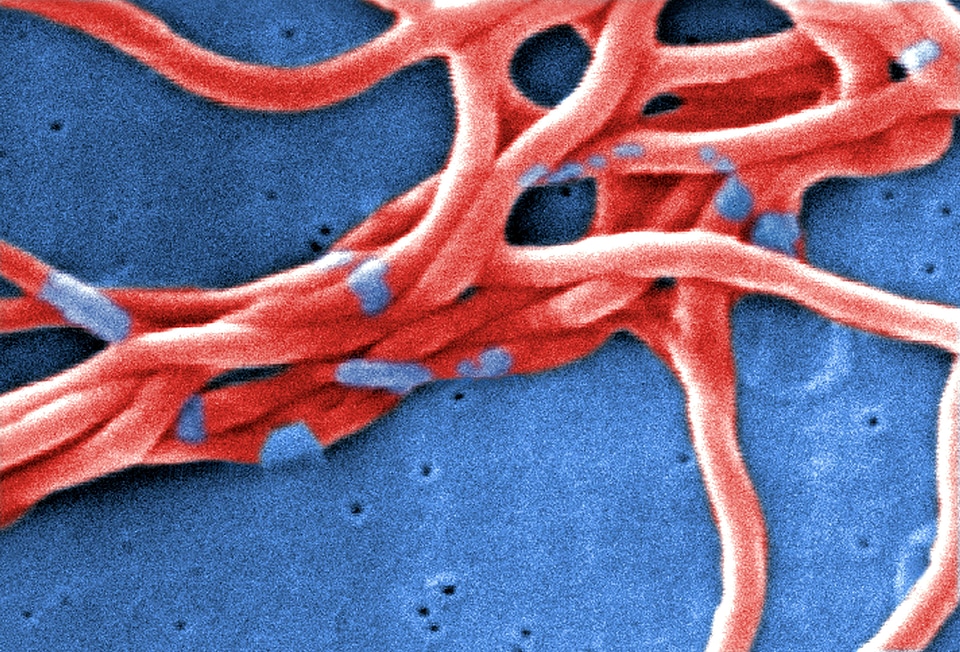 Bacteria Borrelia spirochaetaceae electron micrograph