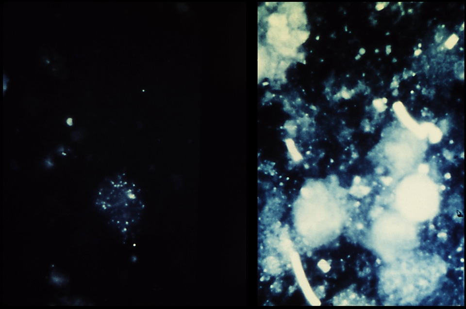 Antibody debris scrub