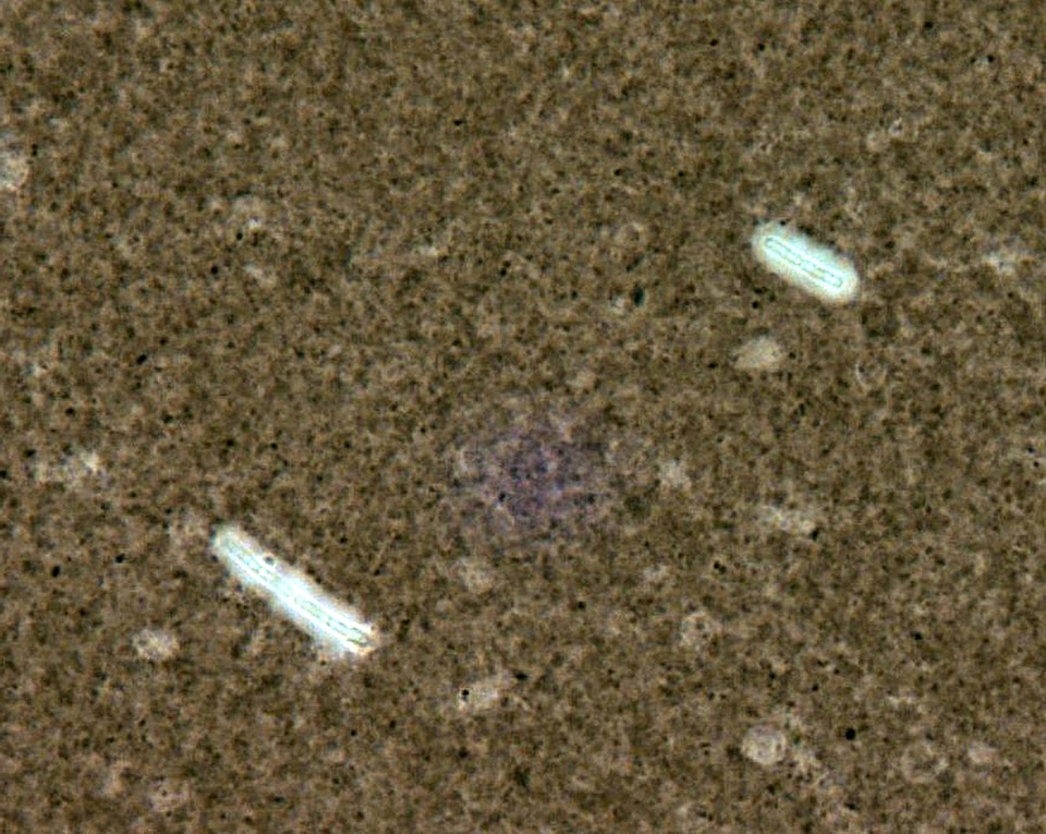 Bacillus capsule scrub