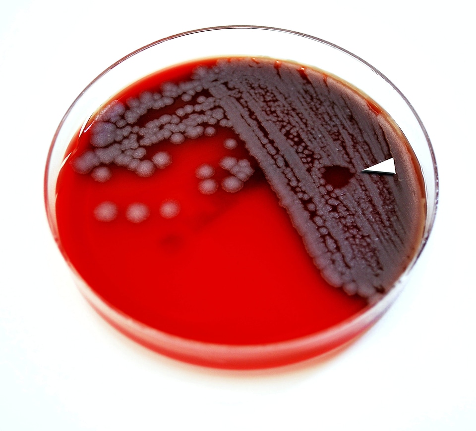Bacteria gamma specific