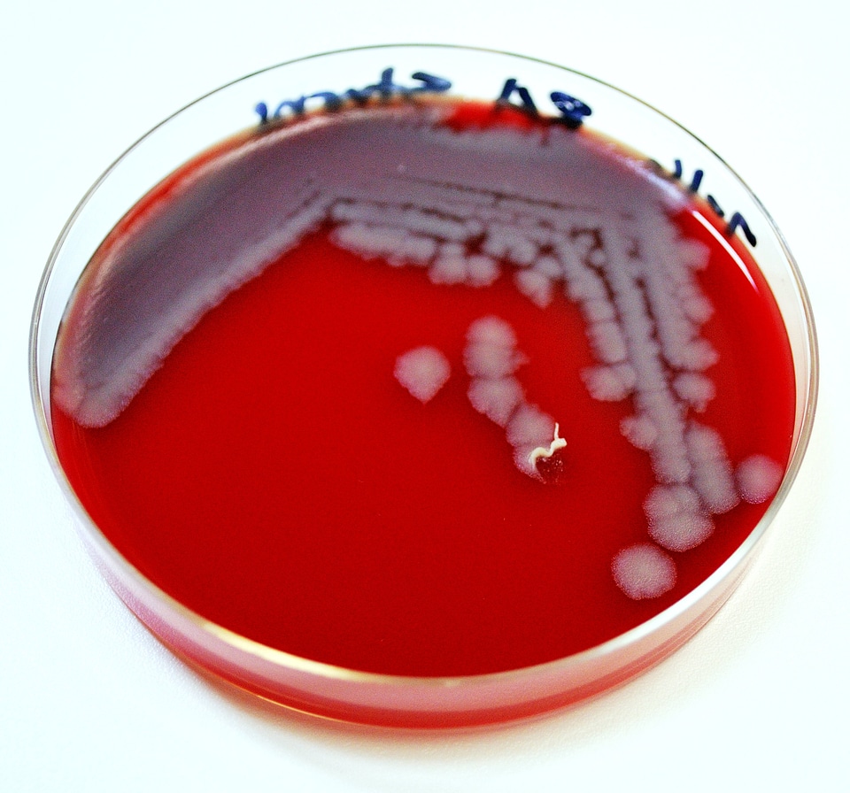Bacillus image photo