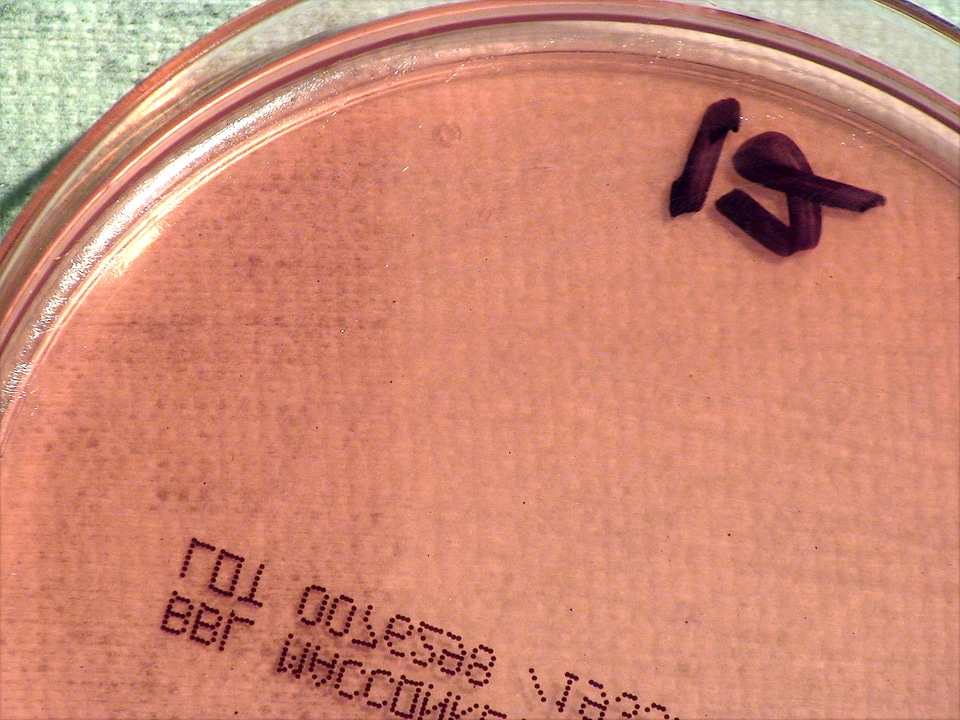 Anthrax causal agent disease