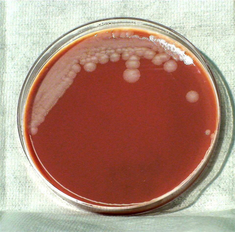 Aerobe bacillus spore