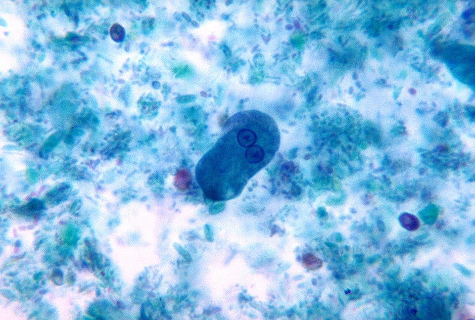 Cyst escape intestine