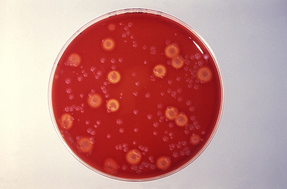 Blood blood agar bottom