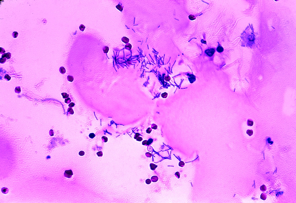 Anthrax autumn bacillus