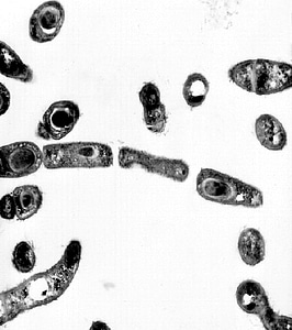Bacillus electron electron micrograph photo