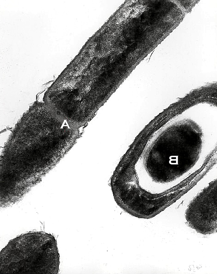 Anthrax bacillus culture