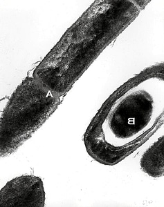Anthrax bacillus culture photo