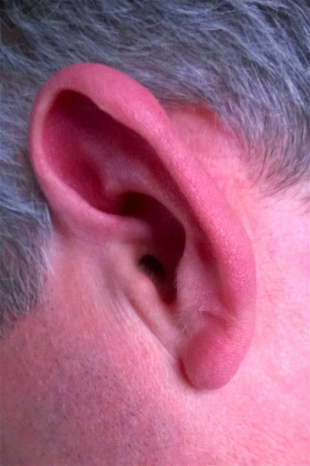 Project 365 #93: 030415 Ear Ear!