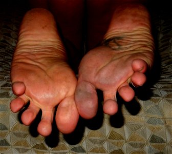 Timi's Feet