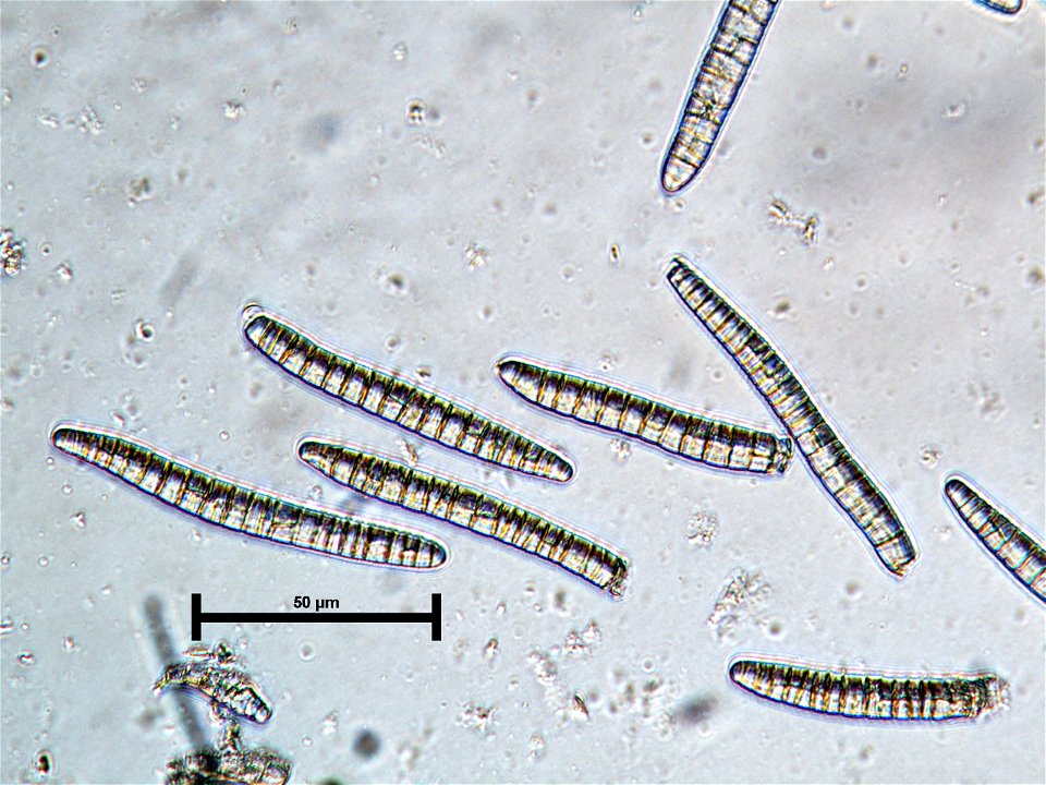 Dichomera-gemmicola-asexual-spores-Tongass