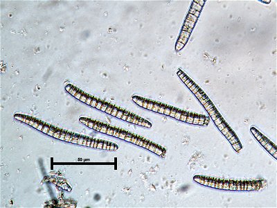 Dichomera-gemmicola-asexual-spores-Tongass