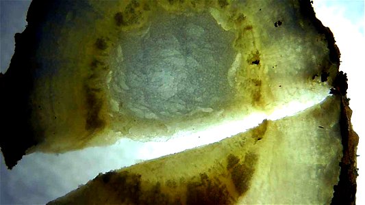 Dandelion root and stem cross sections under magnification