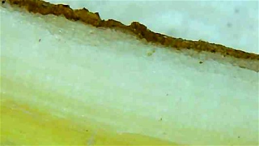 Dandelion root and stem cross sections under magnification