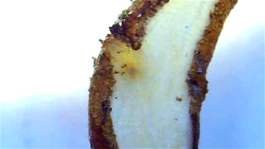 Dandelion root and stem cross sections under magnification