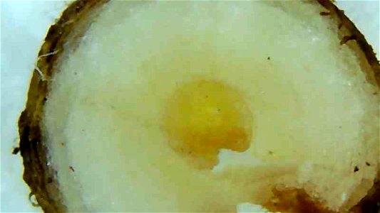 Dandelion root and stem cross sections under magnification