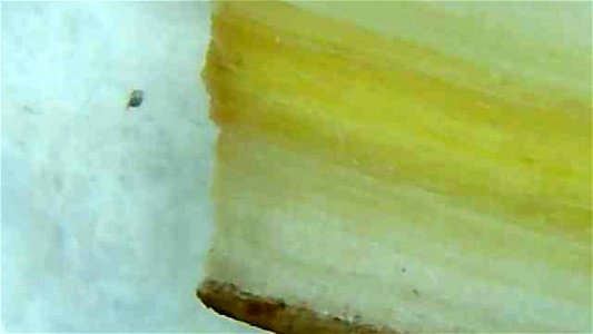 Dandelion root and stem cross sections under magnification