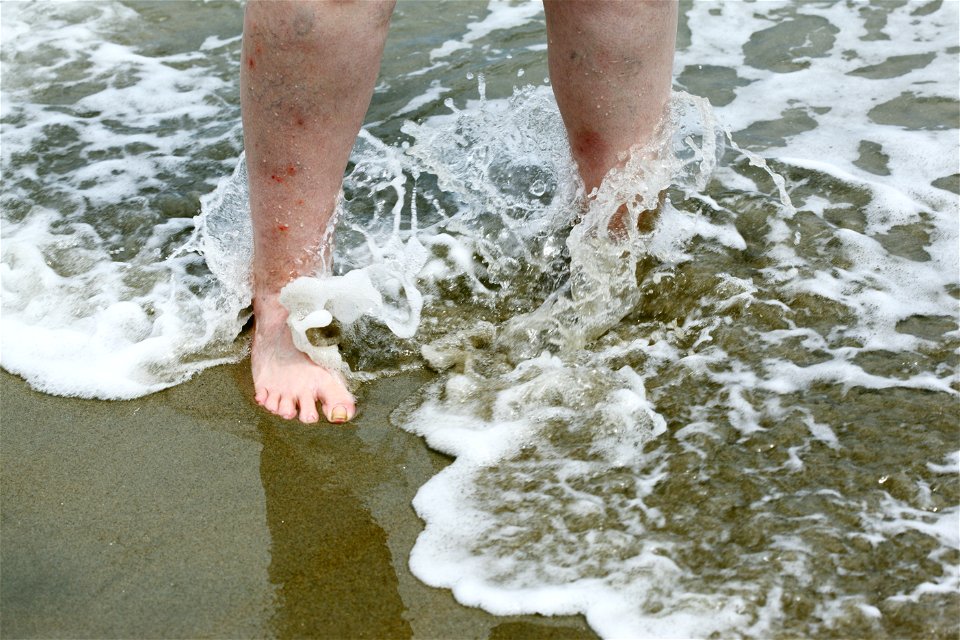 person with Damaged, Injured, Bruised Legs in Ocean Waves photo