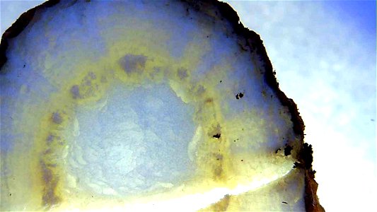 Dandelion root and stem cross sections under magnification