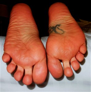 Timi's Bare Soles