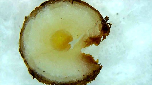Dandelion root and stem cross sections under magnification