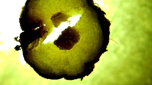 Dandelion root and stem cross sections under magnification