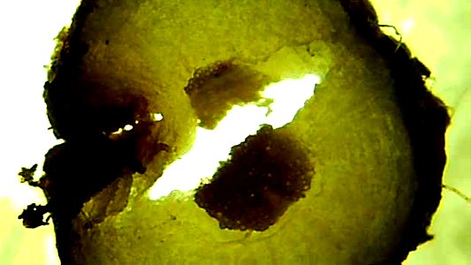 Dandelion root and stem cross sections under magnification