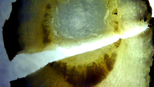 Dandelion root and stem cross sections under magnification