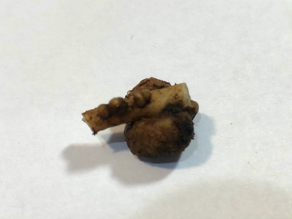 Nitrogen nodule on Lupine root