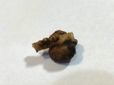 Nitrogen nodule on Lupine root