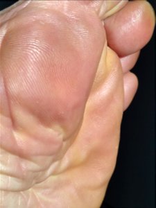 Nepdi foot sole