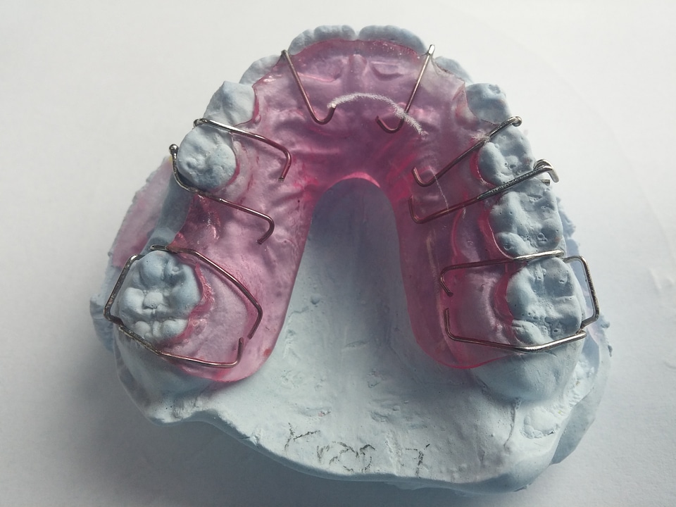 Rails dental braces tooth