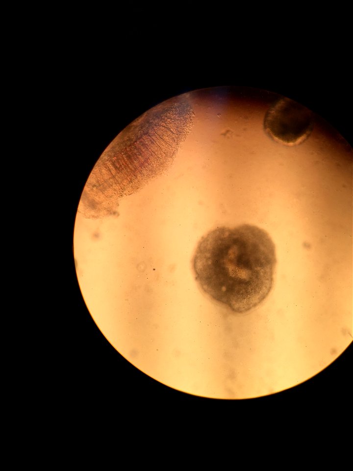 Parasite Under a Microscope photo