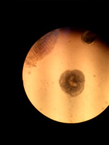 Parasite Under a Microscope