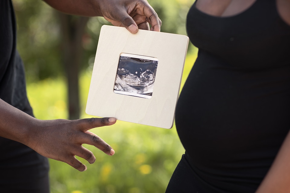 Sonogram picture sonogram
